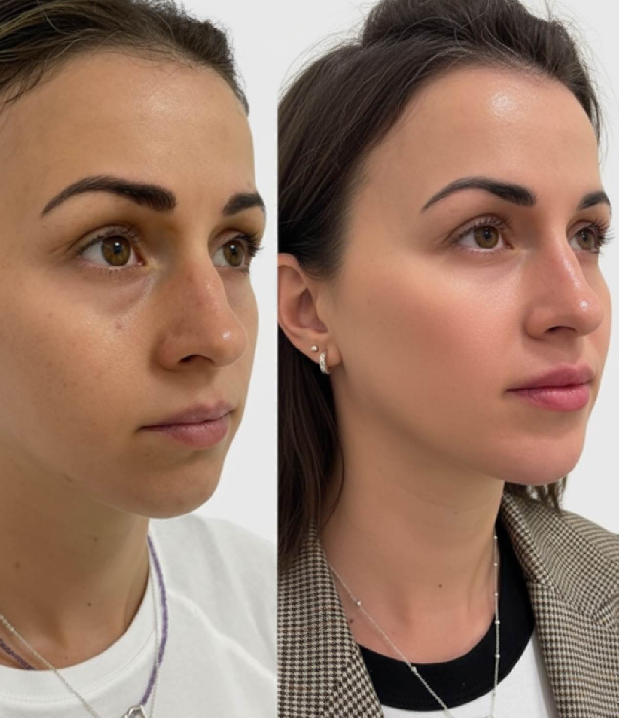 Tratamientos de medicina estética en Valencia – Clínica Etérea