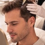 Aplicación de tratamiento médico anticaída en hombre en Clínica Etérea Valencia bajo supervisión especializada.