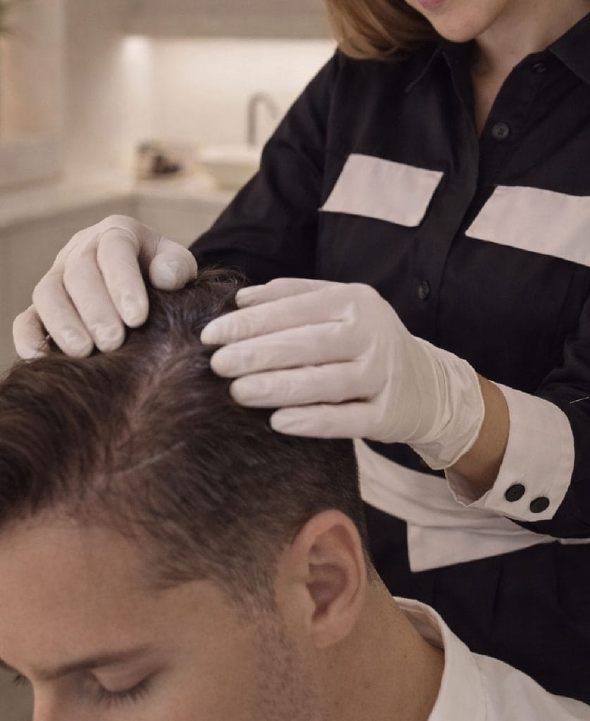 Valoración de alopecia en paciente masculino por especialista en medicina capilar en Valencia.